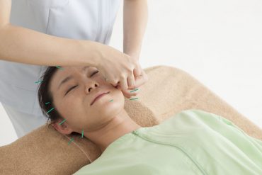 Shuxin acupunctuur stress behandeling