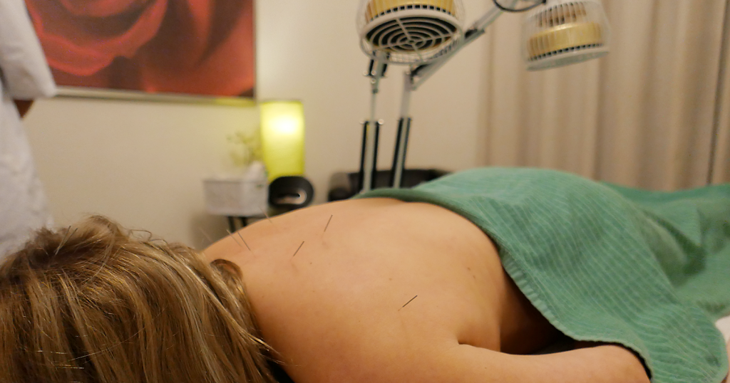 Op basis  van de persoonlijke diagnose van uw klachten plaats de  acupuncturist een aantal zeer kleine naaldjes verspreid over uw lichaam.  Daarna mag u 30-45 minuten ontspannen. 